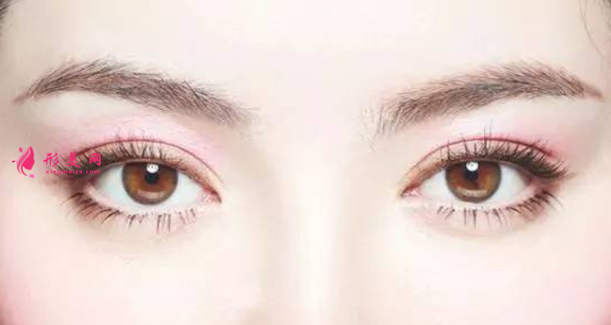 廣州美萊雙眼皮整形多少錢