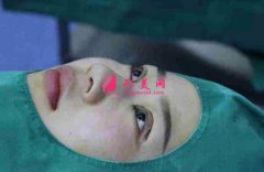 上海九院整形科怎么樣？附雙眼皮30天恢復(fù)真實(shí)記錄