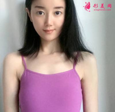 在中關(guān)村整形美容醫(yī)院找宋春瓊做自體脂肪隆胸手術(shù)前