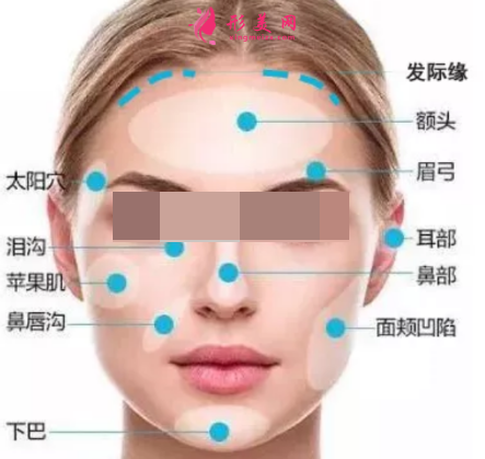 面部脂肪填充多久可以消腫