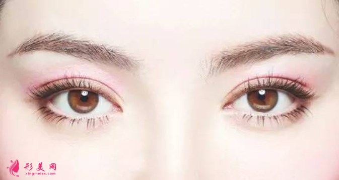 割雙眼皮的手術(shù)費(fèi)用是多少呢