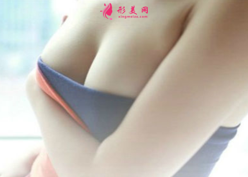 胸部下垂矯正需要注意什么