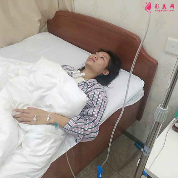 人要學(xué)會憐惜自己的整形術(shù)后圖片