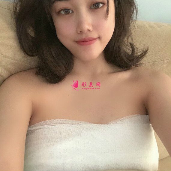 閉眼聽風(fēng)的整形術(shù)后圖片