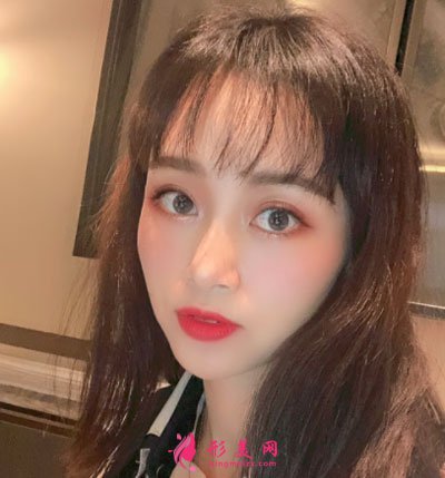 蘇州美貝爾整形美容醫(yī)院自體脂肪面部填充案例