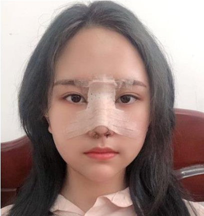 西安交大一附院整形科怎么樣？全新價(jià)格表+案例參考