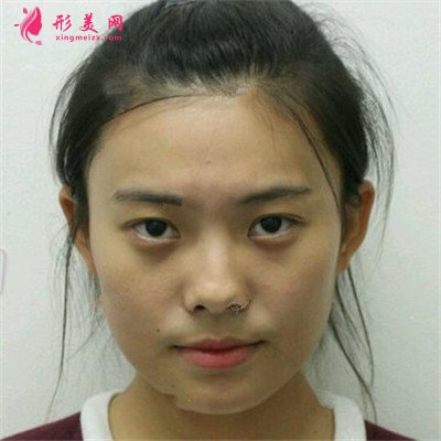 7c807d4e3b5c-half.jpg 7c807d4e3b5c-half.jpg