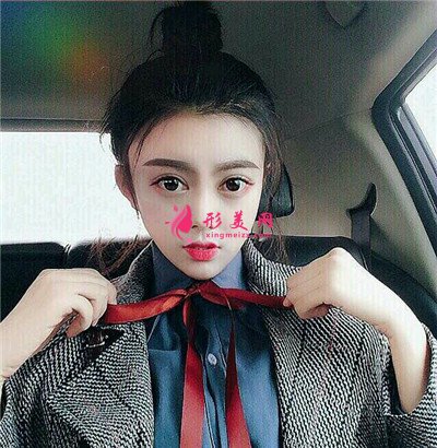 杭州全切雙眼皮術(shù)后恢復(fù)效果反饋 術(shù)后 杭州全切雙眼皮術(shù)后恢復(fù)效果反饋