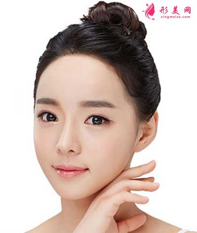 重慶割雙眼皮需要多少錢?有哪些注意事項?