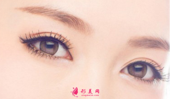 埋線雙眼皮術(shù)后能化妝嗎