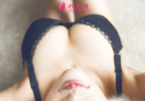 隆胸假體型號大小要怎么選