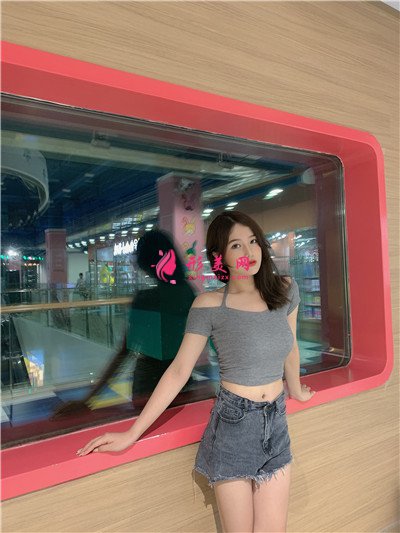 北京腰腹吸脂手術(shù)術(shù)后恢復(fù)案例分享