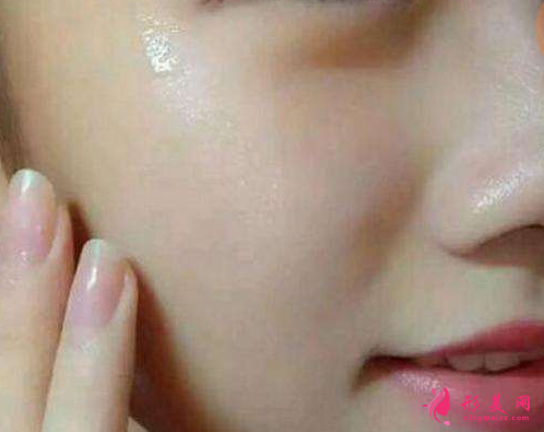 激光祛斑后有反黑癥狀正常嗎