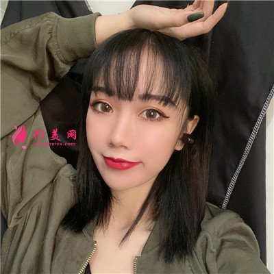 蘇州小姐姐全切雙眼皮術(shù)后效果對比