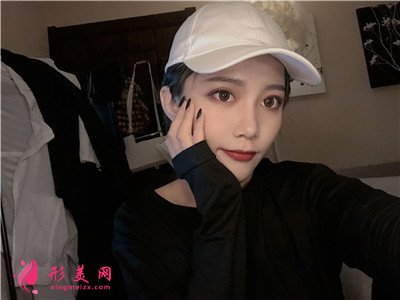 杭州面部線雕術(shù)后恢復(fù)情況反饋 術(shù)后 杭州面部線雕術(shù)后恢復(fù)情況反饋