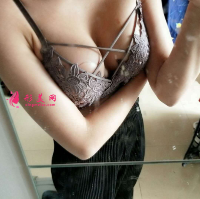 嬌點醫(yī)學(xué)美容醫(yī)院隆胸案例 術(shù)后65天效果圖分享