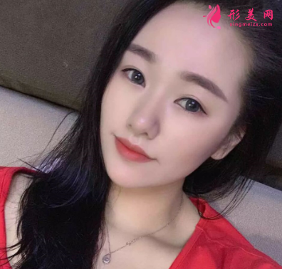 長虹醫(yī)療分享光子嫩膚真實(shí)案例 術(shù)后94天效果圖