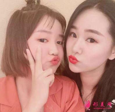 長虹醫(yī)療分享光子嫩膚真實(shí)案例 術(shù)后94天效果圖