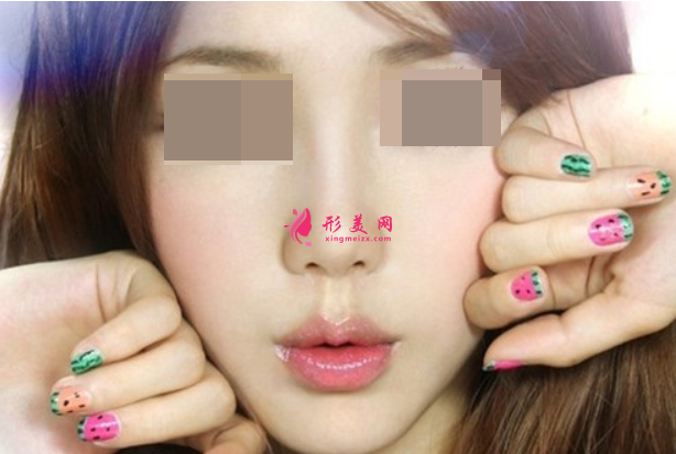 黃金超皮秒祛斑效果可以保持多久