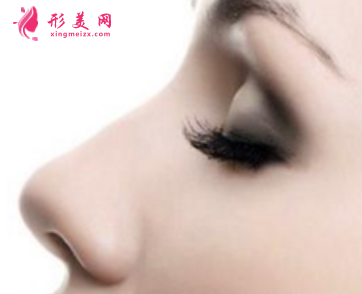 自體軟骨隆鼻失敗了可以取出嗎