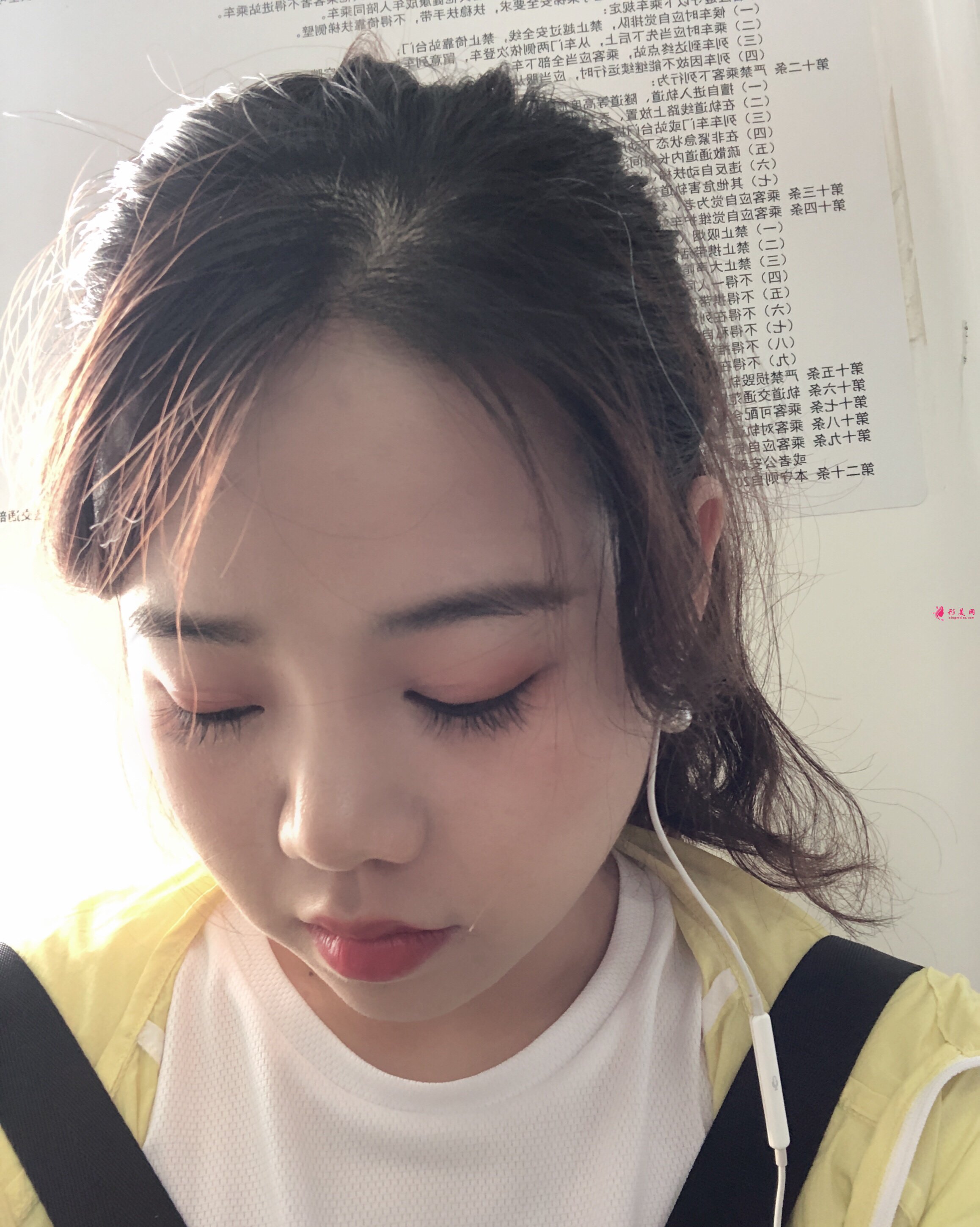 植發(fā)后還會(huì)脫發(fā)嗎？