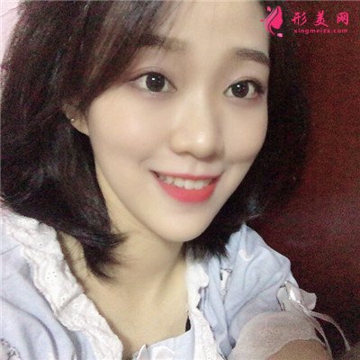 杭州面部埋線提升術(shù)后恢復(fù)情況對比 術(shù)后 杭州面部埋線提升術(shù)后恢復(fù)情況對比