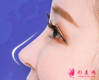 假體隆鼻術(shù)后需要做的護(hù)理事項(xiàng)