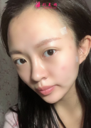 上海華美醫(yī)院線雕怎么樣？一次線雕就能讓你抗衰老好多年