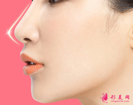 假體隆鼻費(fèi)用受什么因素影響