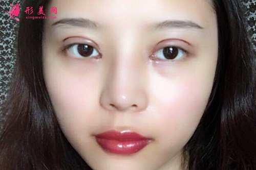 603c2952f312-audio.jpg 603c2952f312-audio.jpg