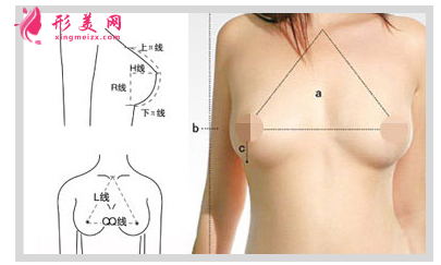 假體隆胸價(jià)格費(fèi)用是多少