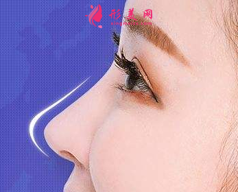 假體隆鼻整形需要多久恢復(fù)好