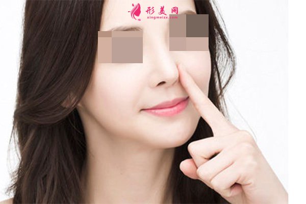縮鼻翼手術(shù)后遺癥明顯嗎