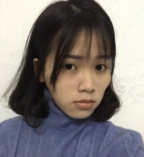 上海九院顴骨內(nèi)推多少錢？全新價格表來襲！附案例分享