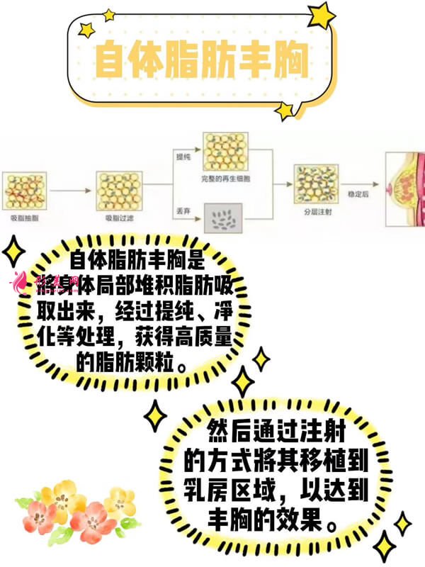 自體脂肪豐胸過程圖.jpg
