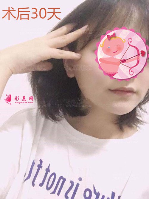 重慶華美潘寶華磨骨案例