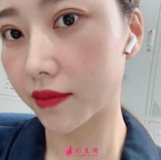 濟(jì)南海峽醫(yī)院去眼袋價(jià)格多少？案例和2021收費(fèi)標(biāo)準(zhǔn)一起看