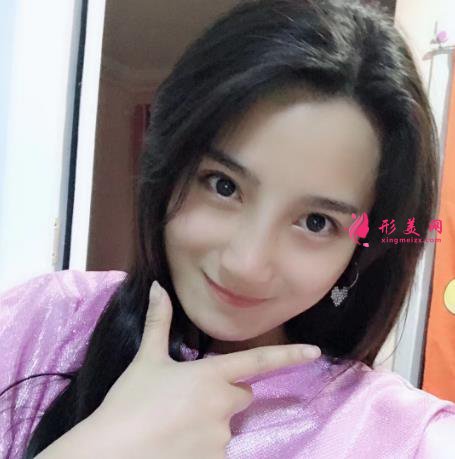 鄭州大學第一附屬醫(yī)院整形科怎么樣？隆鼻價格及恢復效果展示