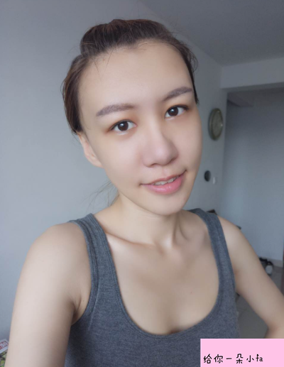 北京純脂馮斌脂肪填充怎么樣?看看術(shù)后效果怎么樣? 北京純脂馮斌脂肪填充怎么樣?看看術(shù)后效果怎么樣?