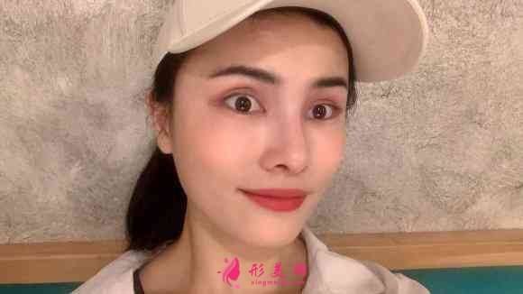 南昌時光整形是三甲醫(yī)院嗎？附玻尿酸隆鼻效果對比及2021價格表發(fā)布