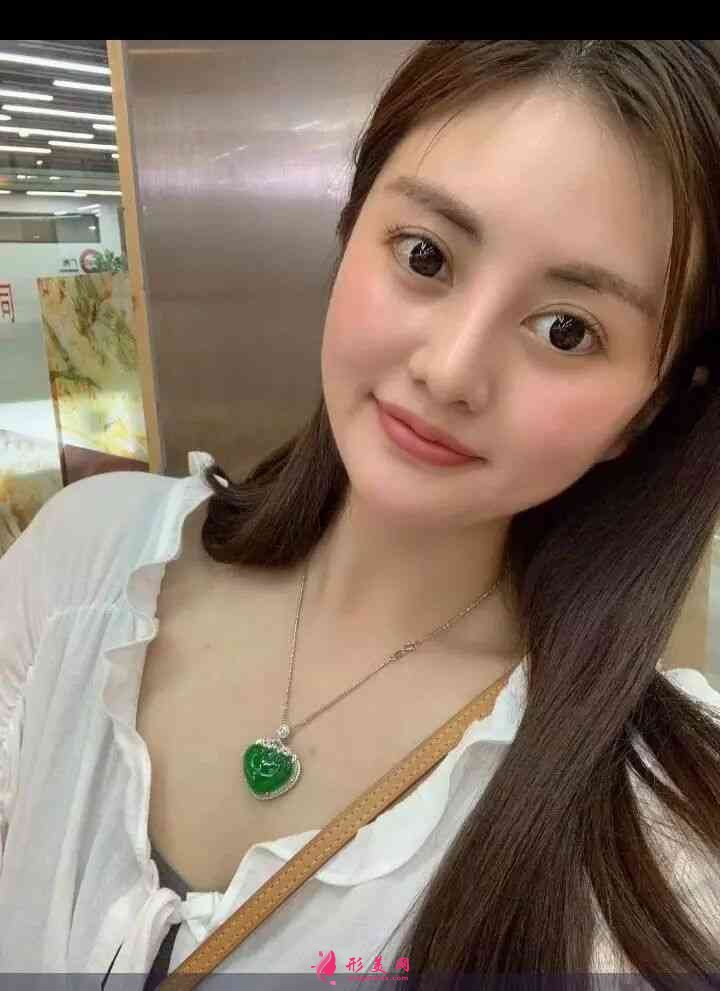 北京畫美醫(yī)療美容醫(yī)怎么樣？2021價格表公布+玻尿酸豐唇案例分享