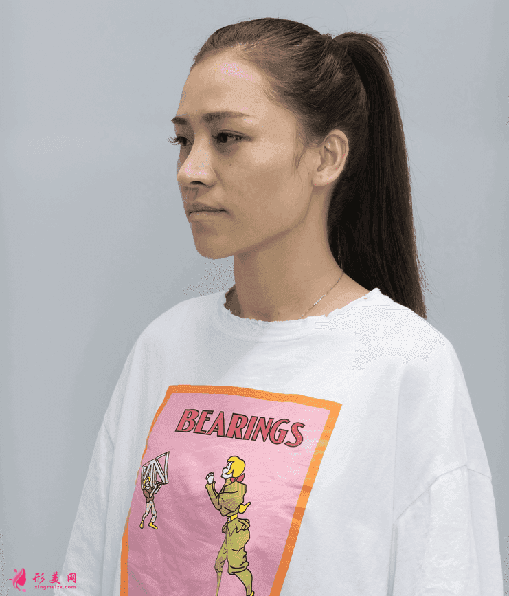 深圳富華美容醫(yī)院口碑怎么樣？2021價格表公開+鼻修復(fù)案例分享