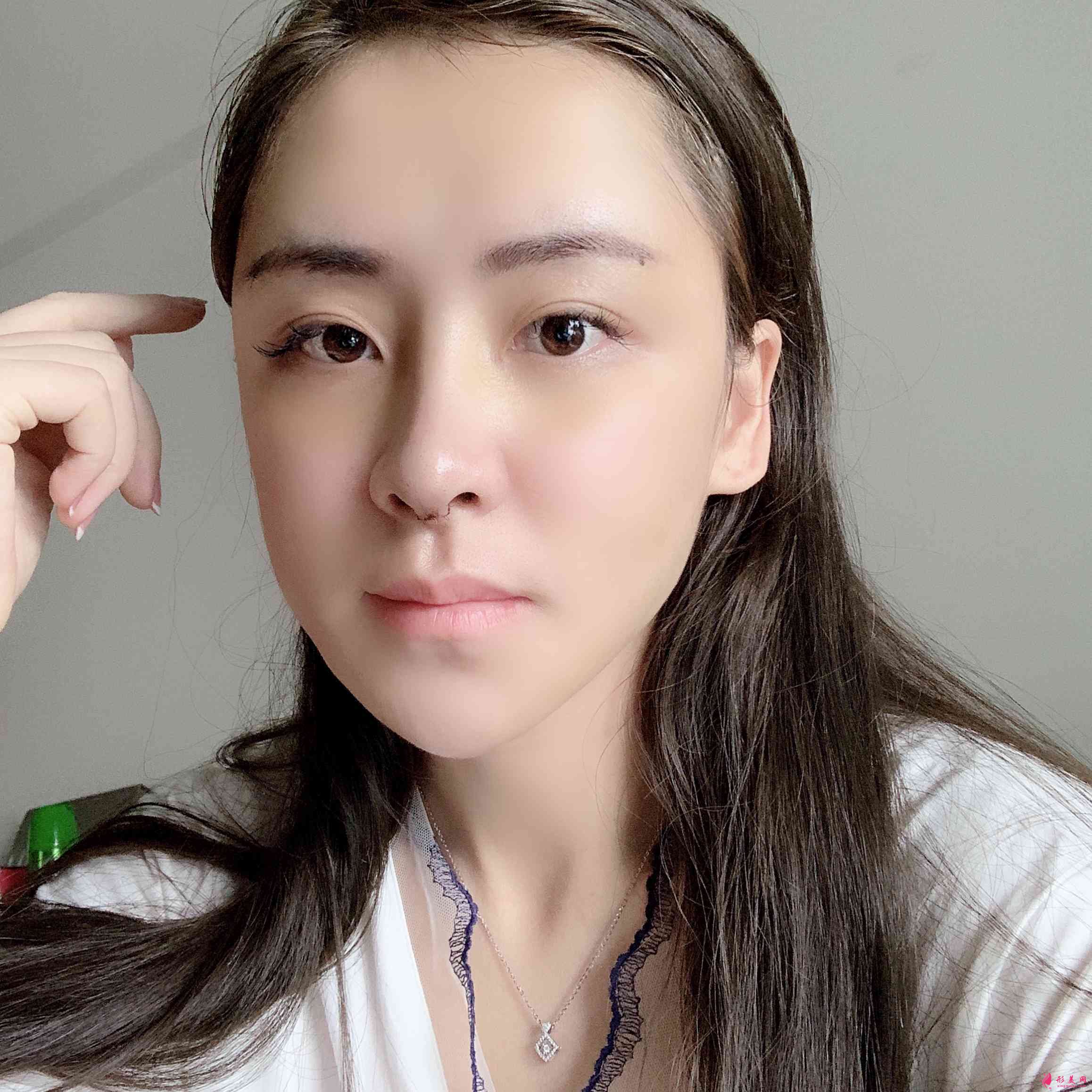 深圳富華美容醫(yī)院口碑怎么樣？2021價格表公開+鼻修復(fù)案例分享