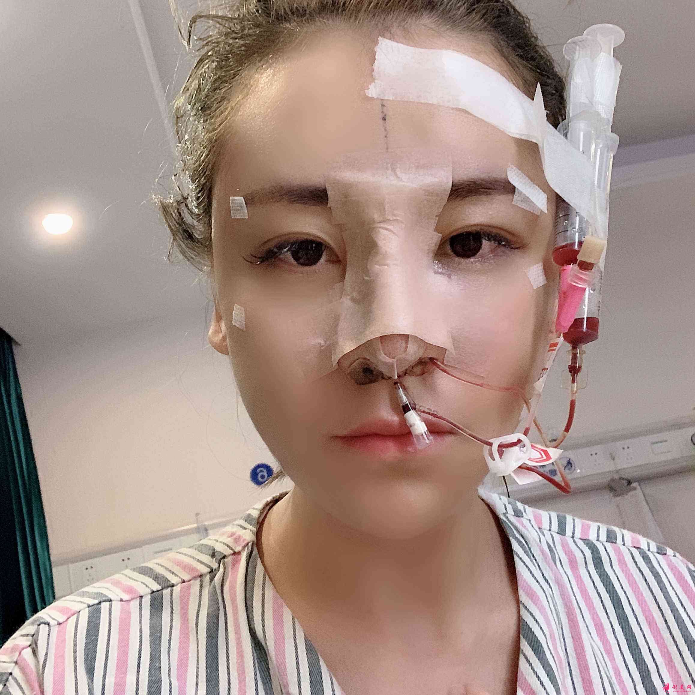 深圳富華美容醫(yī)院口碑怎么樣？2021價格表公開+鼻修復(fù)案例分享