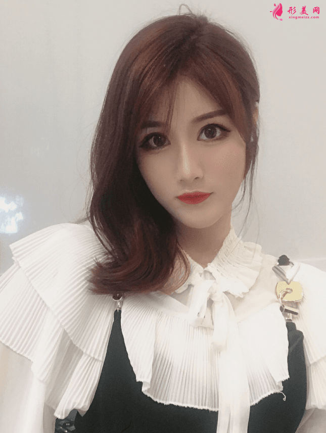 哈醫(yī)大四院美容科李巍隆鼻怎么樣？附隆鼻真人案例及2021價(jià)格表