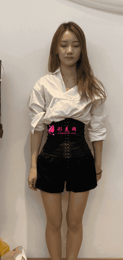 沈陽(yáng)軍區(qū)總醫(yī)院整形科屬于公立醫(yī)院?jiǎn)?？附吸脂案例?021價(jià)格表公開(kāi)