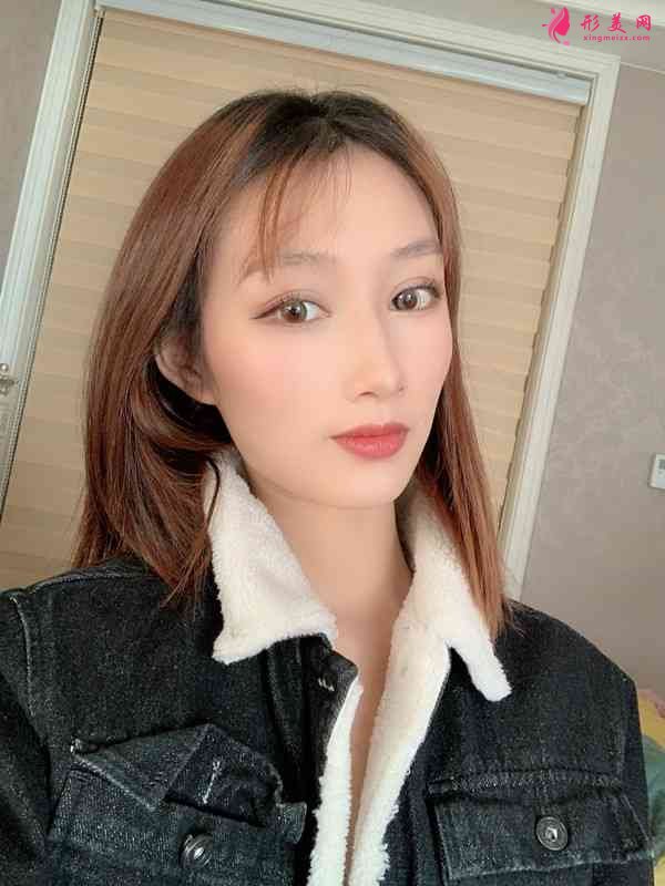 武漢五洲美萊整形怎么樣？2021價格表曝光+下頜角整形日記分享