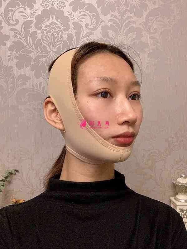 武漢五洲美萊整形怎么樣？2021價格表曝光+下頜角整形日記分享