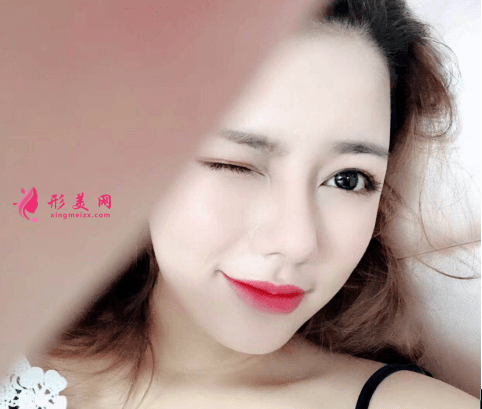 北京八大處隆鼻價格表一覽及隆鼻真人案例分享