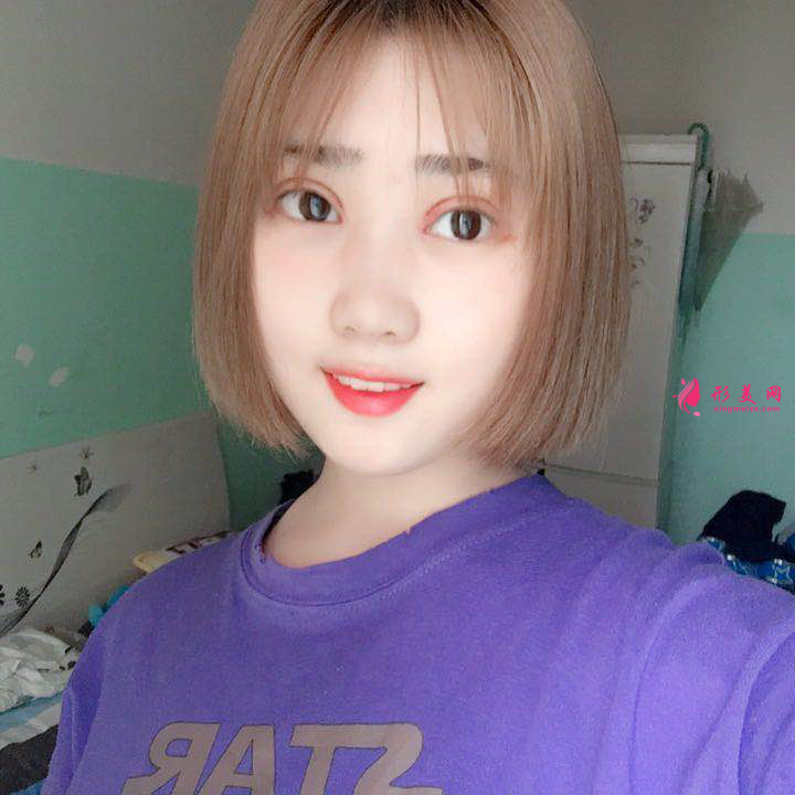 北京八大處雙眼皮多少錢？雙眼皮前后圖片對比+2021價格表曝光